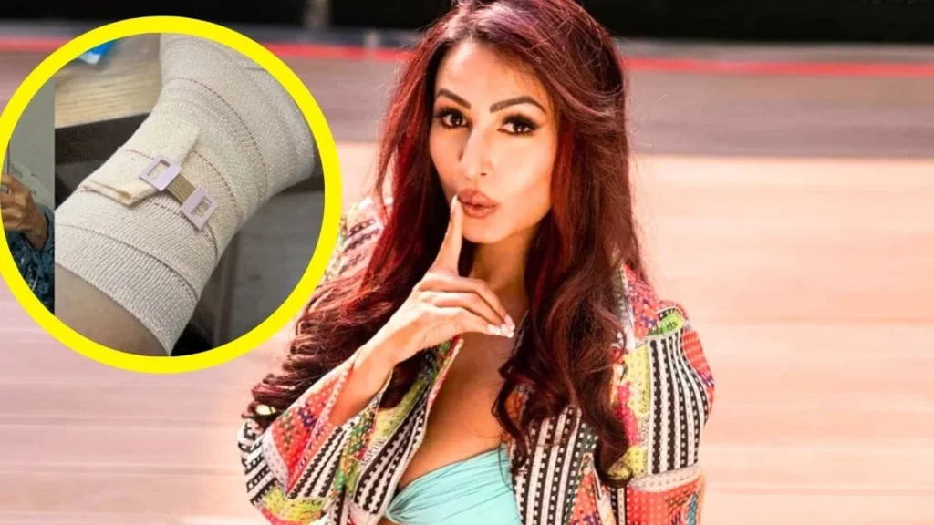 Kashmira Shah Injured on ‘Laughter Chefs’ Keeps Going Strong